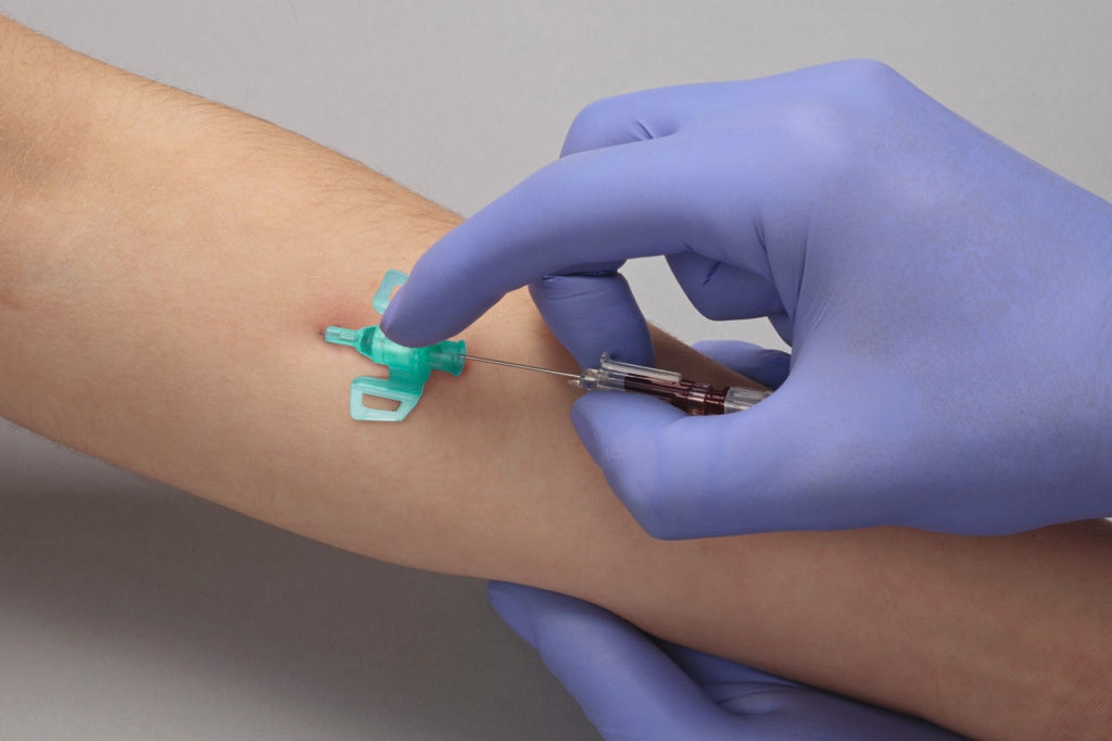 Setzen einer Venenverweilkanüle