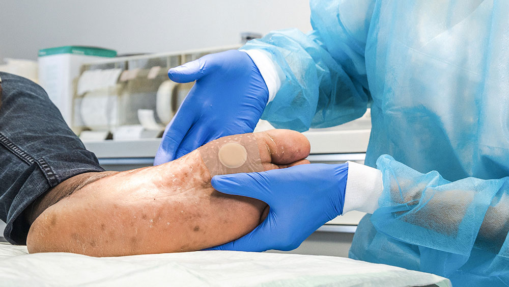 Zwei Hände mit Handschuhen halten einen diabetischen Fuß mit einem Pflaster darauf, im Hintergrund medizinisches Material in einem Arztzimmer